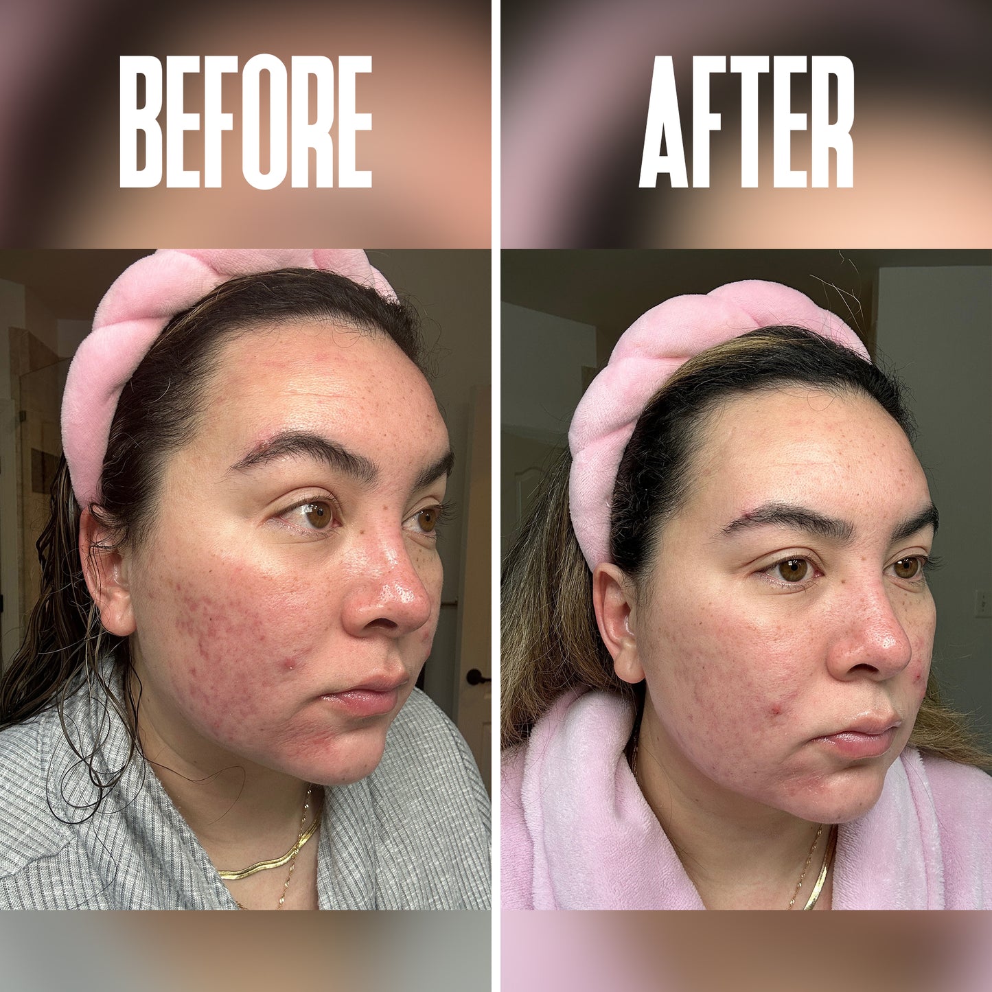Glow Pads with AHA