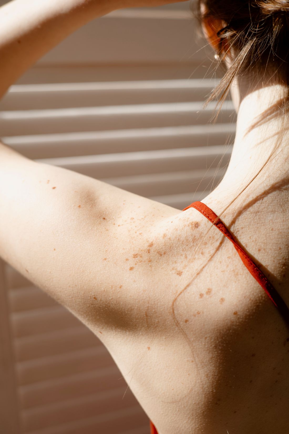 Natural freckles and skin texture on a sunlit shoulder